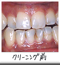 クリーニング前