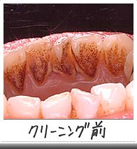 クリーニング前