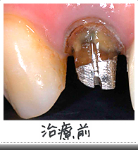 治療前