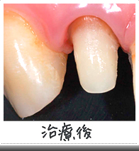 治療後