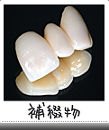 補綴物